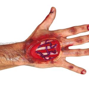 Cicatriz Tendões das Mãos