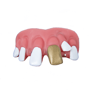Dentadura Dente de Ouro