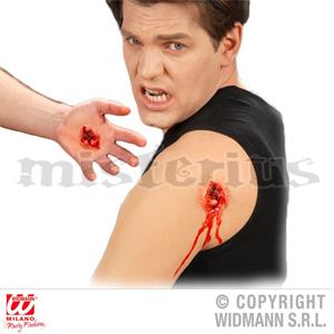 Caracterização Ferida Aberta Caracterização Ferida Aberta